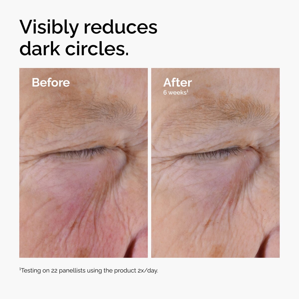caffeine-solution-5-egcg-eye-serum-y3 ord-caffeine-solution-egcg-dark-circles-before-after.jpg