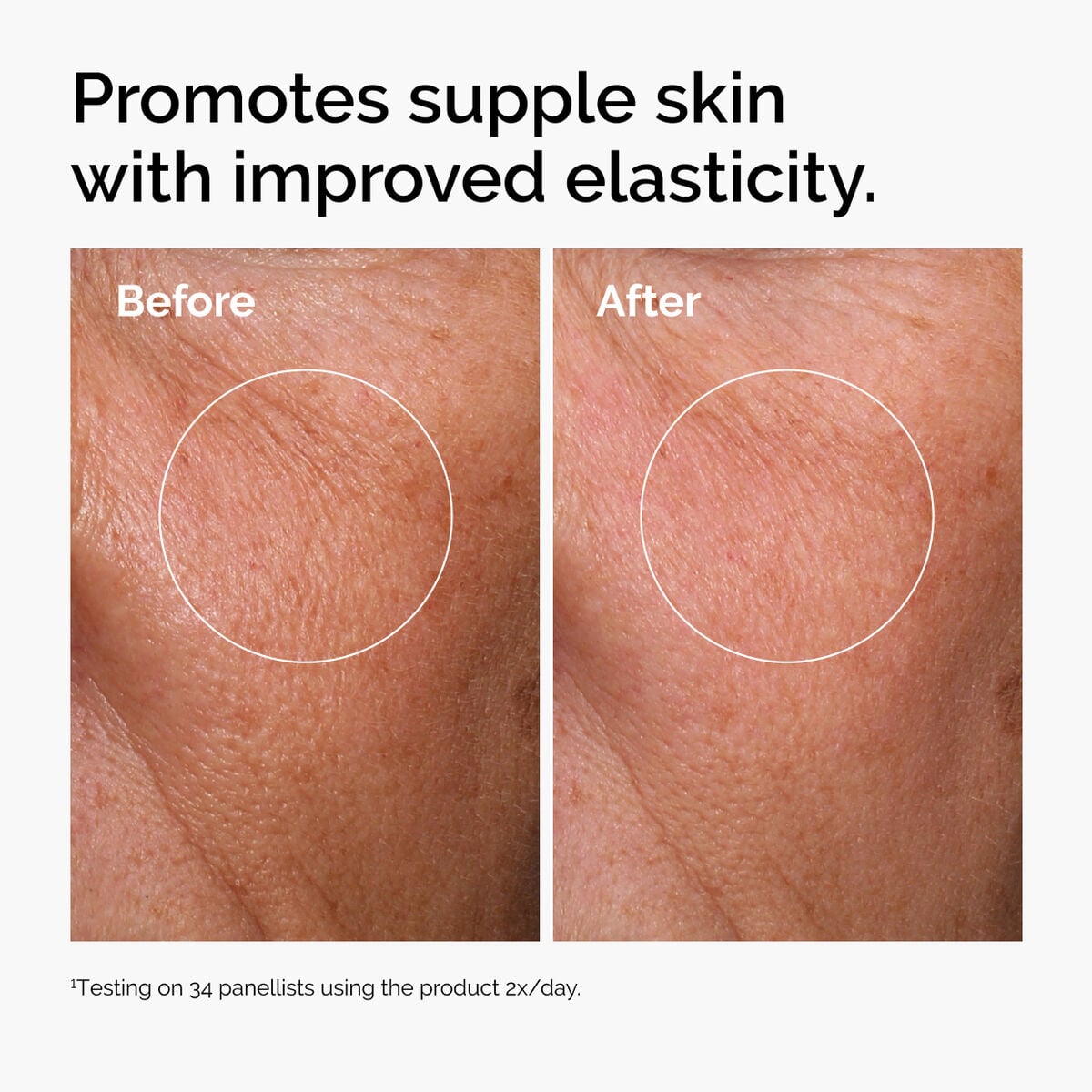 hyaluronic-acid-2-b5-with-ceramides-z1 ord-hyaluronic-acid-2pct-b5-hydrating-serum-before-after-elasticity.jpg