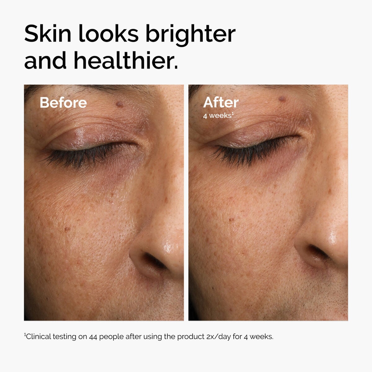 multi-antioxidant-radiance-serum-o8 ord-mars-before-after-healthy.jpg