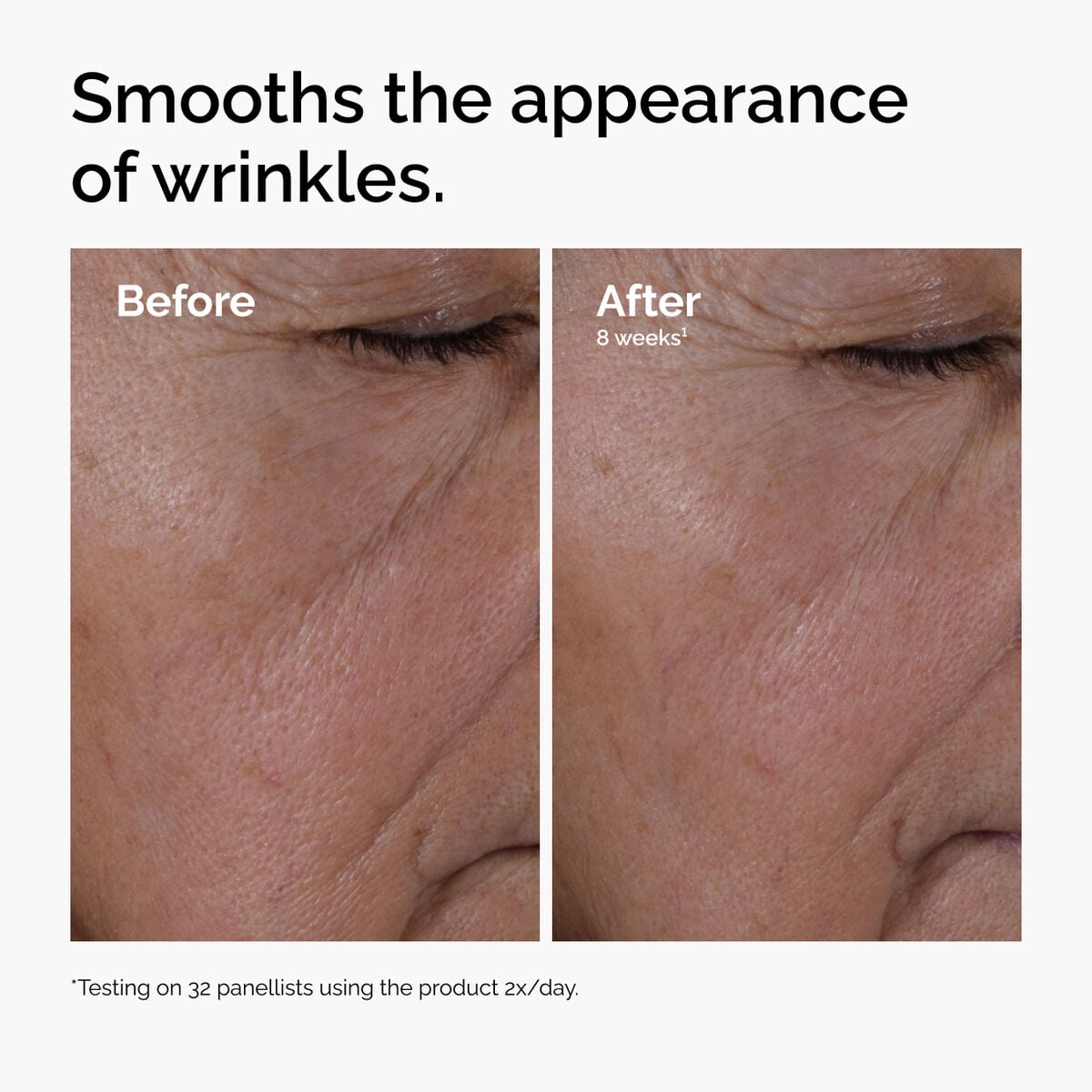 multi-peptide-ha-serum-a0 ord-multi-peptide-ha-serum-wrinkles-before-after.jpg